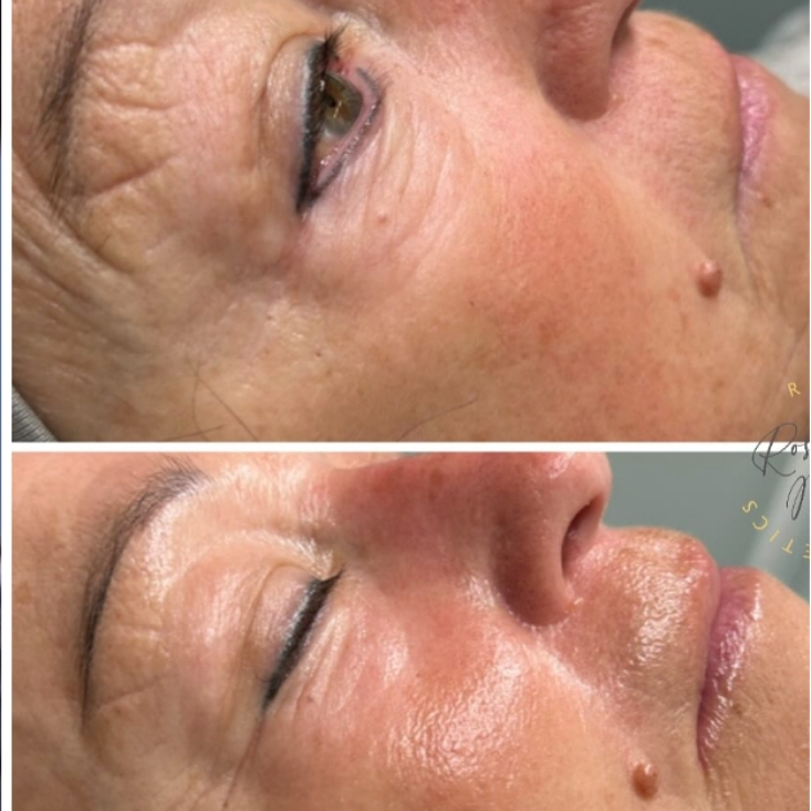 Kosmetikbehandlung Rosa Maria Cosmetics