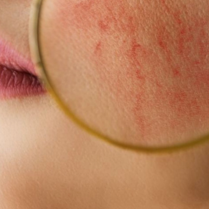 Anti-Aging Behandlung Rosa Maria Cosmetics St. Ingbert