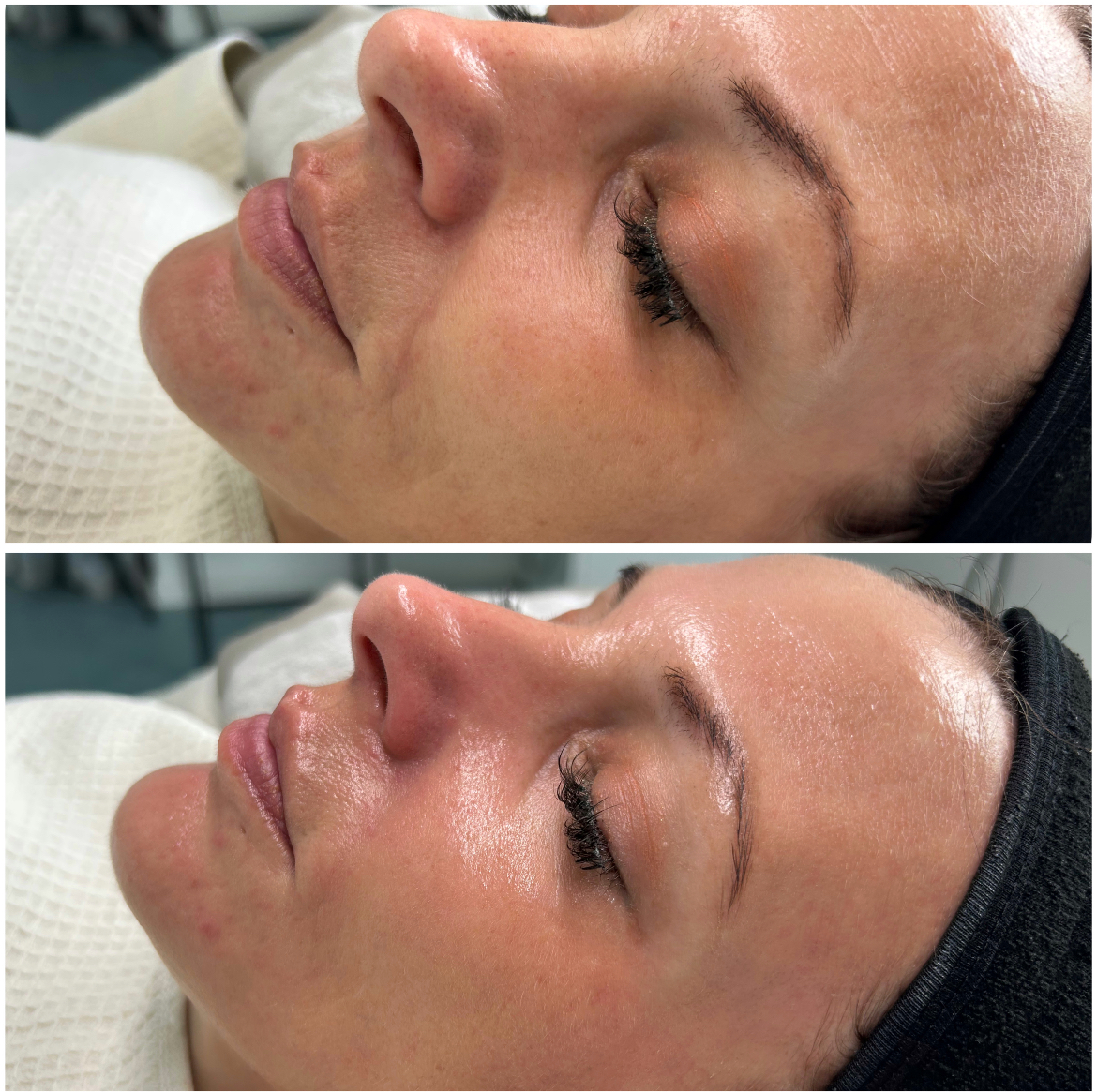Anti-Aging Ergebnis Rosa Maria Cosmetics Saarland