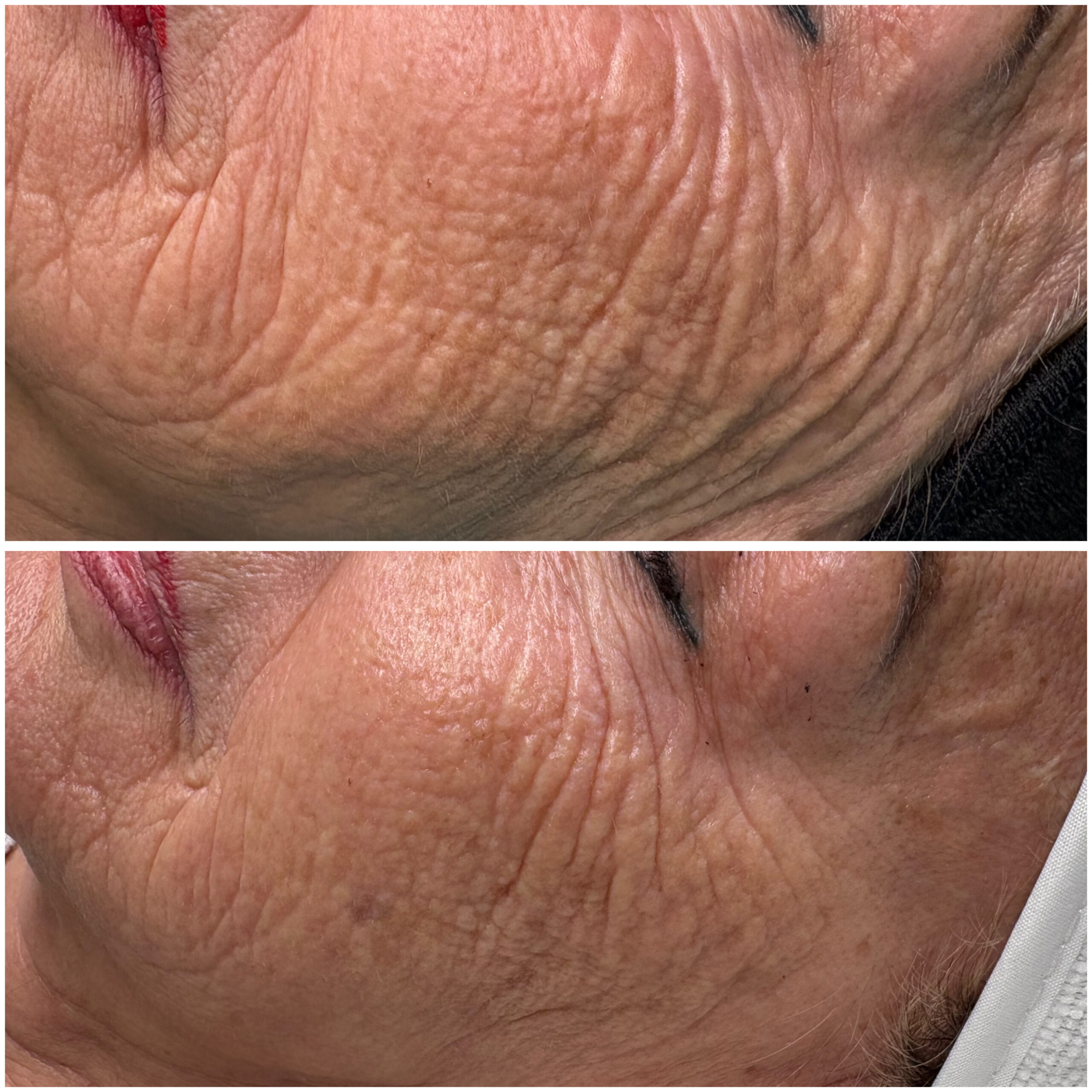 Anti-Aging Ergebnis Rosa Maria Cosmetics Saarland